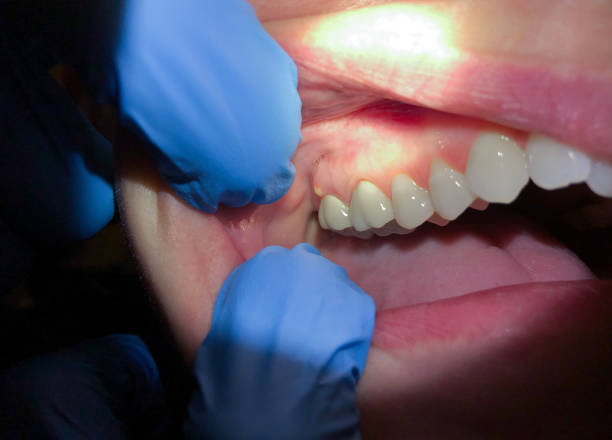 Best Orthodontic Emergency Dentist in Bridgetown, OH