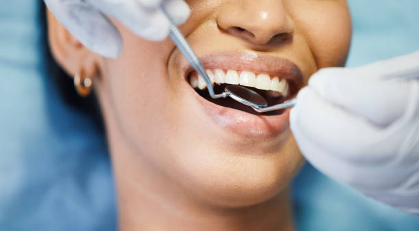 Best Emergency Dentist for Lost Fillings or Crowns in Bridgetown, OH