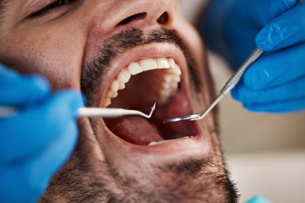 Best Broken or Cracked Tooth Emergency Dentist in Bridgetown, OH